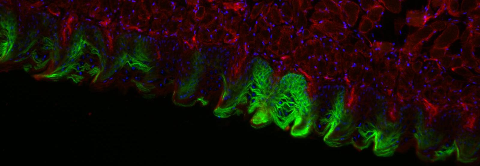 Image of a tongue in a mTmG reporter mouse​
